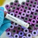Coronavirus-na-cobranca-quais-os-efeitos-e-o-que-esperar-dos-proximos-meses-think-data-televendas-cobranca