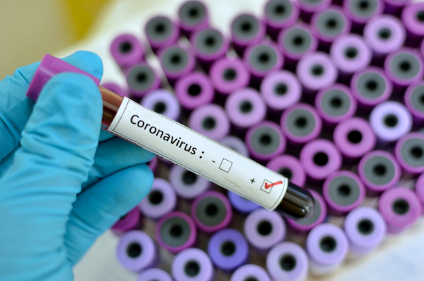 Coronavirus-na-cobranca-quais-os-efeitos-e-o-que-esperar-dos-proximos-meses-think-data-televendas-cobranca