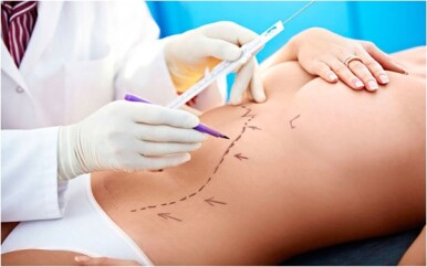 Aparencia-carreira-cirurgiao-plastico-responde-televendas-cobranca-1